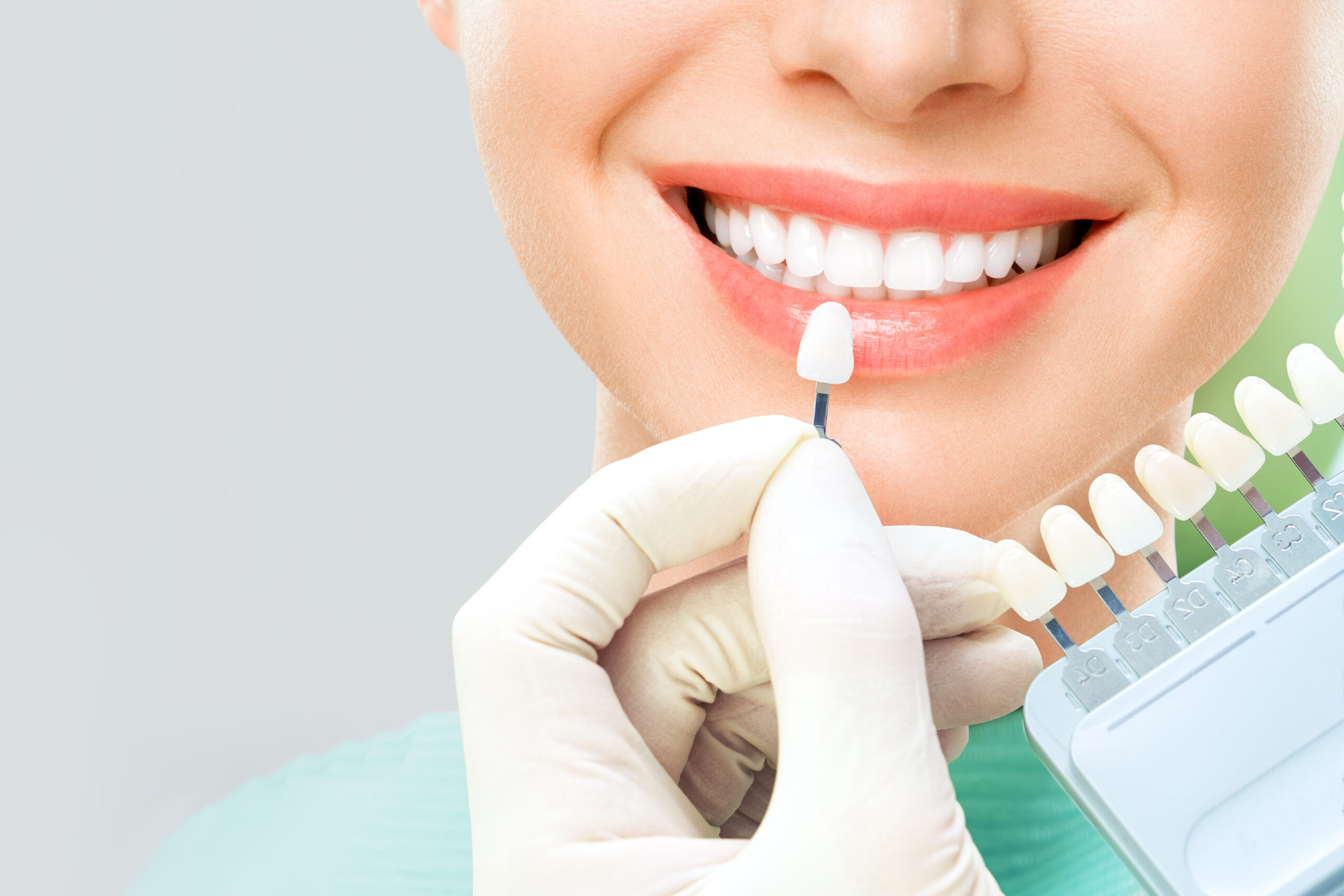 Close up portrait of Young women in dentist chair, Check and select the color of the teeth. Dentist makes the process of treatment in dental clinic office. Teeth whitenning Close up portrait of Young women in dentist chair, Check and select the color of the teeth. Dentist makes the process of treatment in dental clinic office. Teeth whitenning.