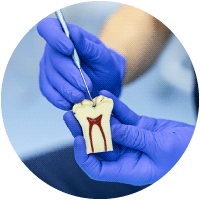 endodonzia https://odontoiatrialatina.it/wp-content/uploads/2023/10/endodonzia.png