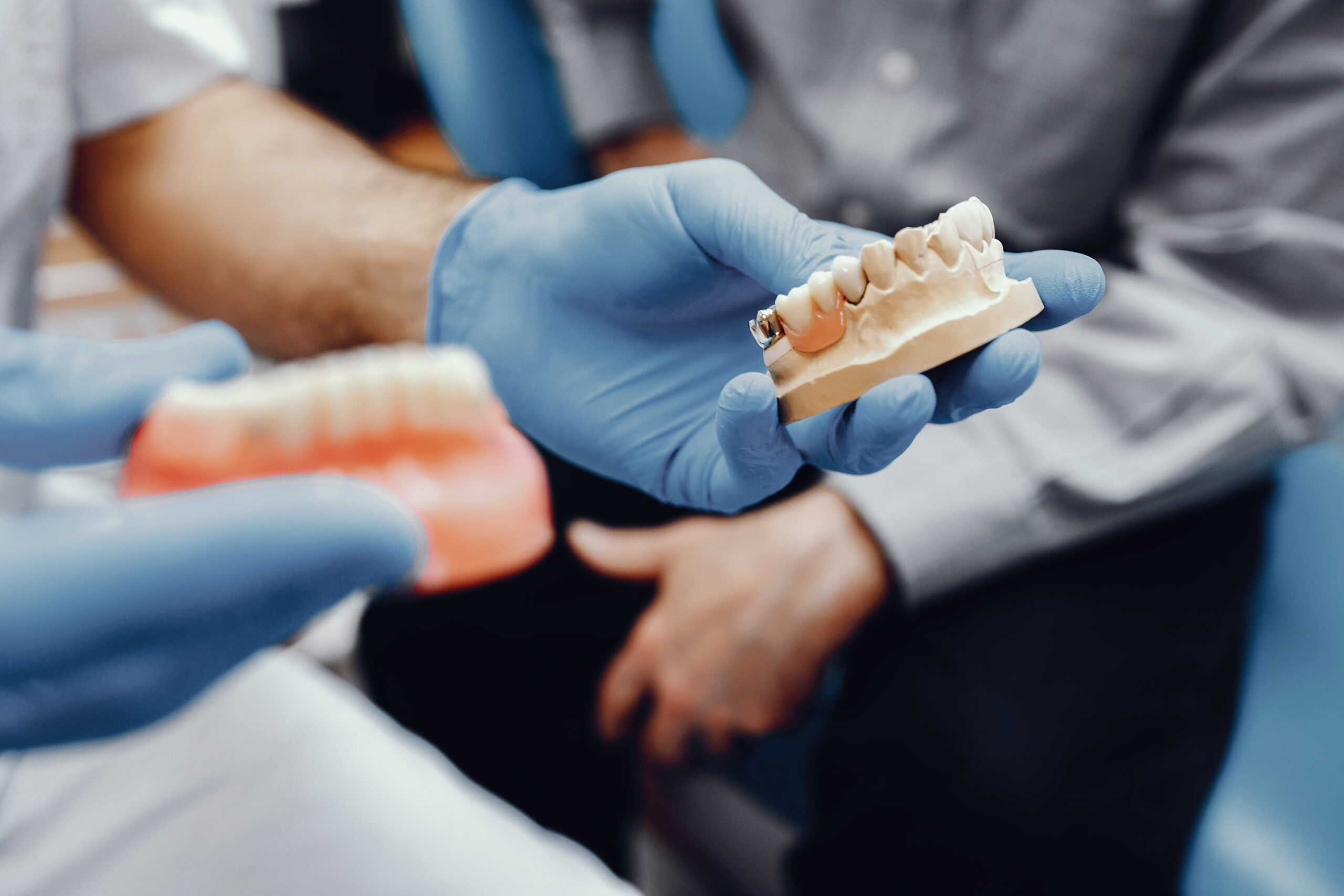 Artificial jaw in the dentist's office Plastic jaw in the dentist's office. The doctor holds in the hands of dental implants.