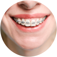 ortodonzia https://odontoiatrialatina.it/wp-content/uploads/2023/10/ortodonzia.png