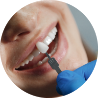 faccette-dentali https://odontoiatrialatina.it/wp-content/uploads/2024/02/faccette-dentali.png