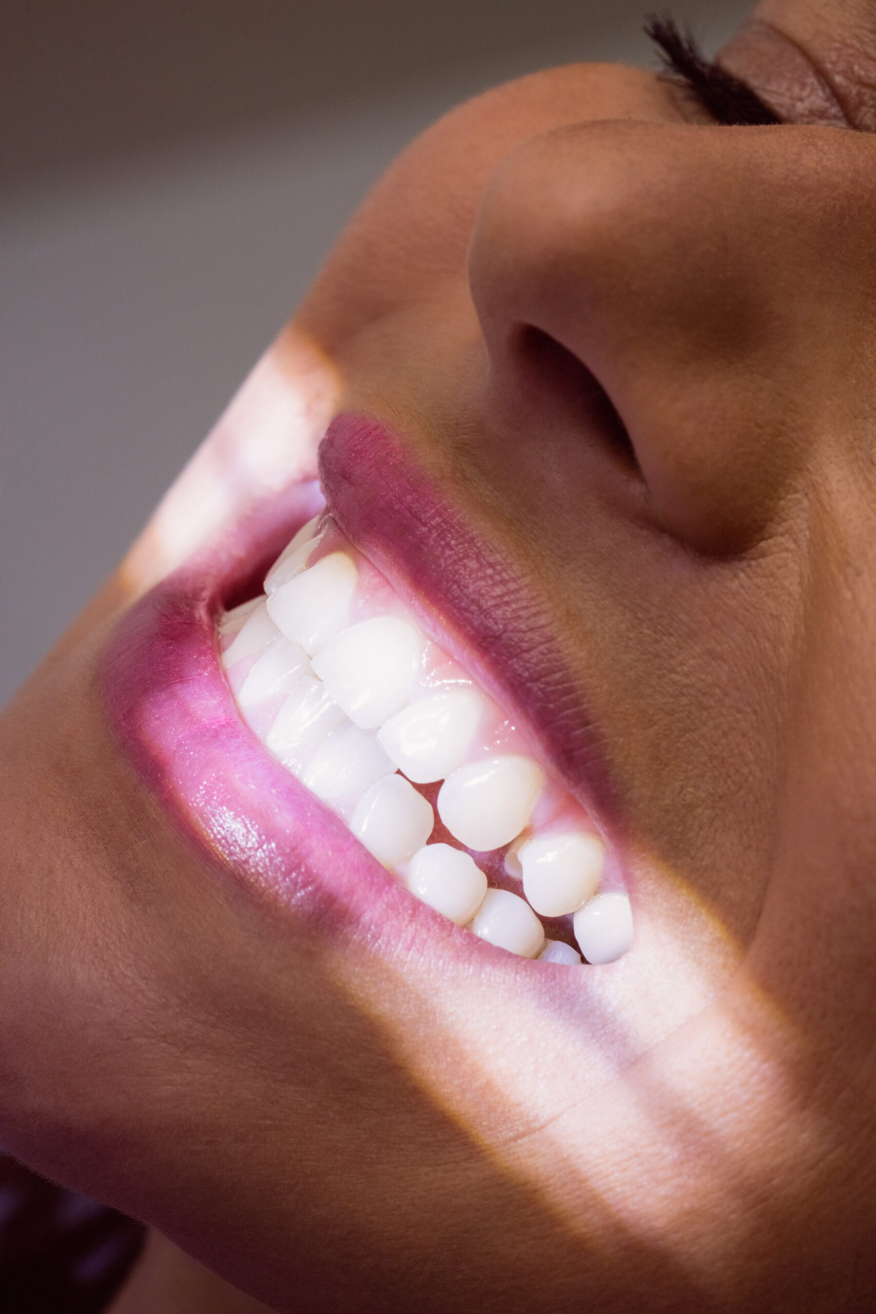 Close-up of female patient receiving a dental treatment at clinic Close-up of female patient receiving a dental treatment at clinic